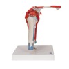 Anatomisch Schoudermodel met afneembare spieren Anatomisch Schoudermodel met afneembare spieren